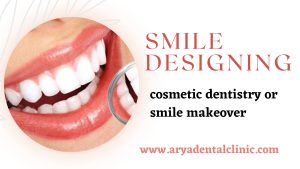 Read more about the article Smile designing:- cosmetic dentistry or smile makeover