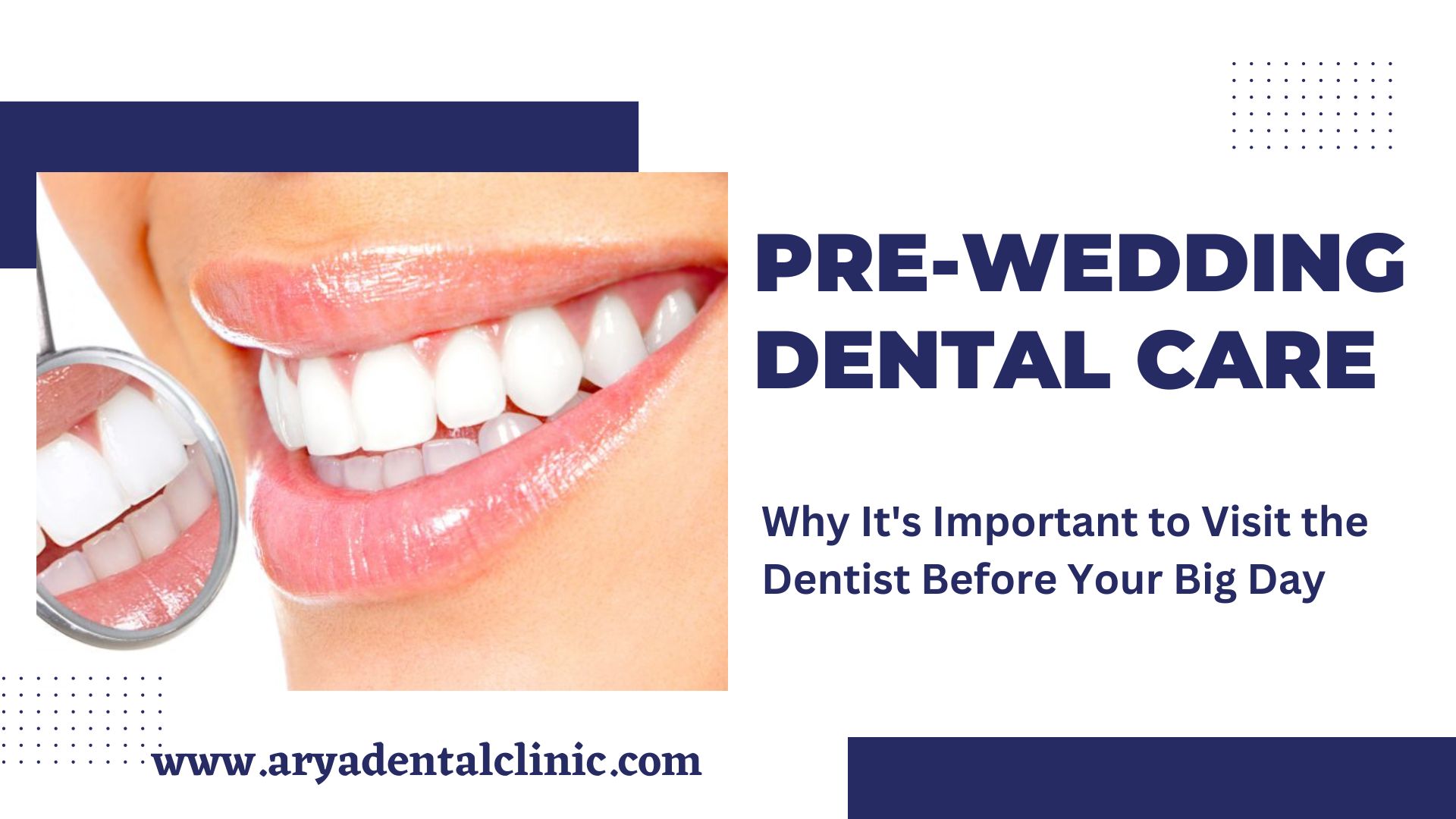 You are currently viewing “Pre-Wedding Dental Care: Why It’s Important to Visit the Dentist Before Your Big Day”